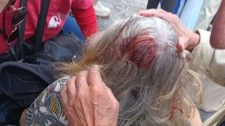 VIDEO: un policía le dio un palazo en la cabeza a una jubilada en el Congreso