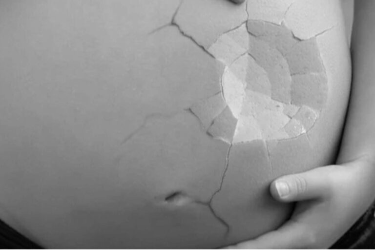 El Centro O’Neill impulsa el debate y promueve agenda asesina del aborto en R.D.