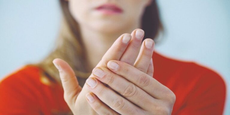 Mujer joven con síntomas de esclerodermia en las manos