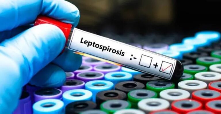 Operativo sanitario por leptospirosis en Bariloche