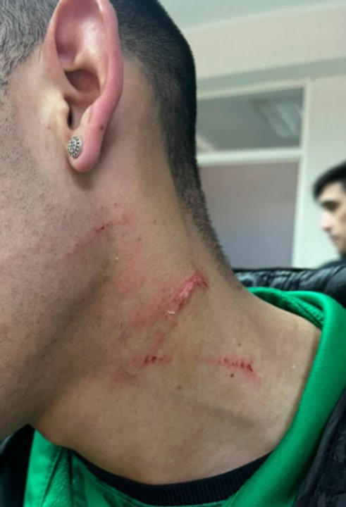 Jugadores de Laprida con lesiones visibles tras el partido contra Huracán