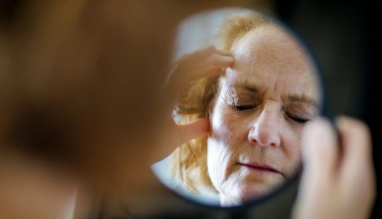 Mujer con dolor de cabeza, migraña